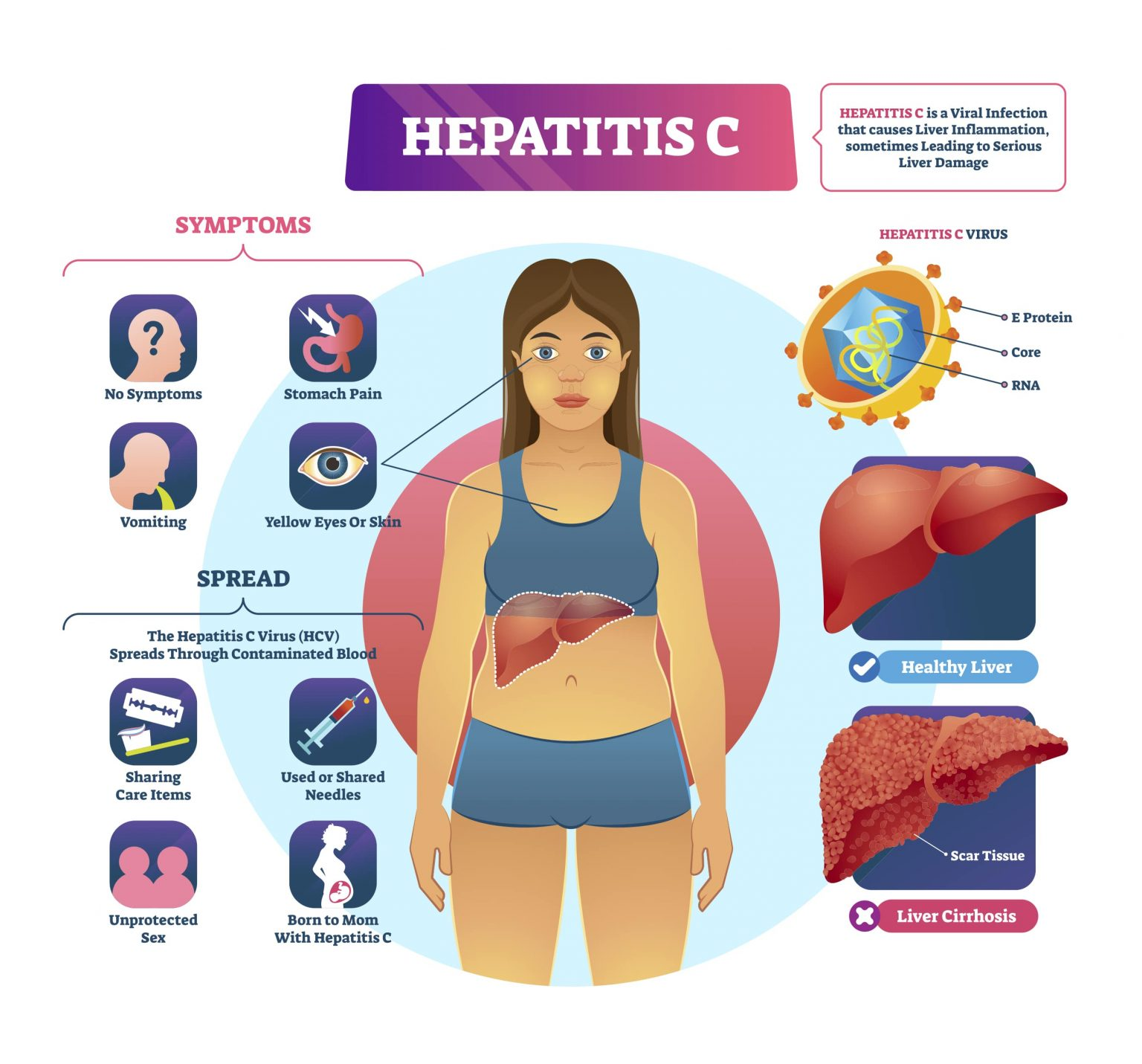 https://www.gutcare.com.sg/wp-content/uploads/2024/01/Hepatitis-C-min-1536x1431-1.jpg