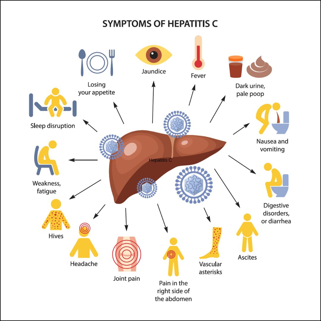 Hepatitis C: Causes, Risk Factors, Symptoms, Treatment