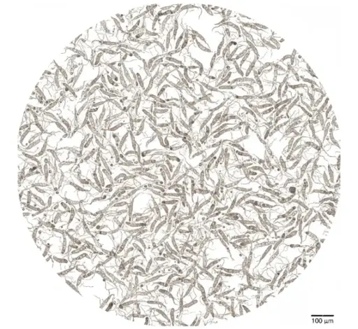 [0089-CAF117] Human Lung Squamous Cell Carcinoma CAFs